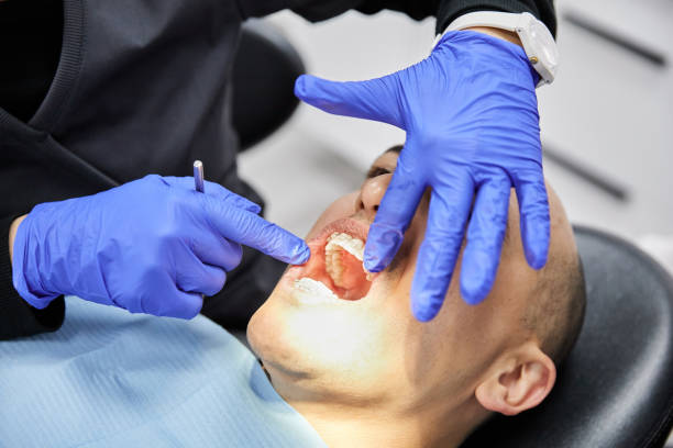 Best Emergency Dentist for Knocked-Out Tooth in Lake Arrowhead, CA